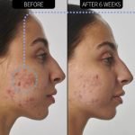 The Inkey List Scar, Mark And Wrinkle Solution 30ml - Image 2