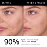 The Inkey List 2% Salicylic Acid Cleanser - Image 2