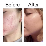 The Inkey List Niacinamide Serum - Image 6