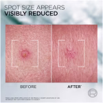 L'Oréal Paris Men Expert Derma Control SOS Pimple Paste with Niacinamide - Image 4