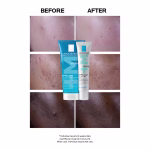 La Roche-Posay Effaclar Duo+M Anti-Blemish Corrective Gel Moisturiser for Oily, Blemish-Prone Skin 15ml - Image 2