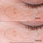 Neutrogena Collagen Bank Reviving Eye Cream 15g - Image 3