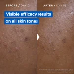 Mixa Niacinamide Bright Moisturising Cream 400ml - Image 3