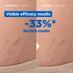 Mixa Stretch Mark Oil 100ml - Image 2